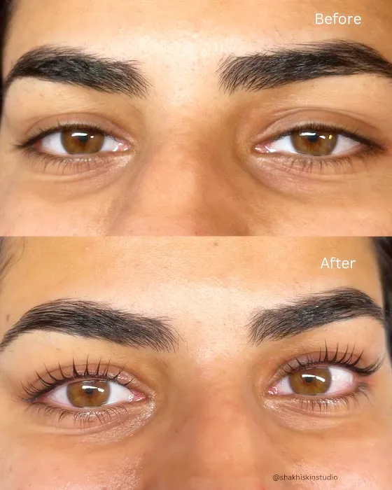 SHAKHI SKIN STUDIO - Santa Clara Facials & Brazilian Waxing Picture 3