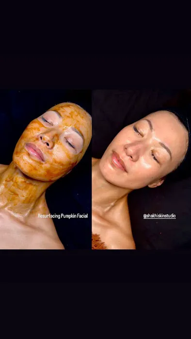 SHAKHI SKIN STUDIO - Santa Clara Facials & Brazilian Waxing Picture 2