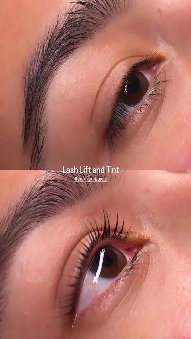 SHAKHI SKIN STUDIO - Santa Clara Facials & Brazilian Waxing Picture 4