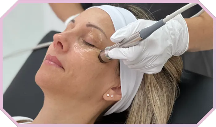The Eye Spa by Optical Illusions | IPL, Radiofrequency, Microneedling Aesthetics Picture 5