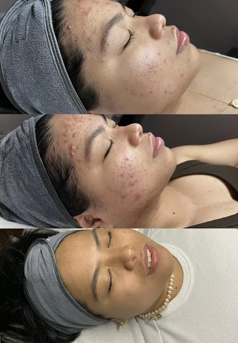 Motiff Aesthetics Picture 4