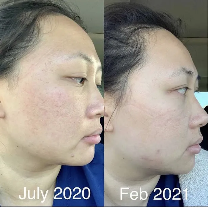 Motiff Aesthetics Picture 7