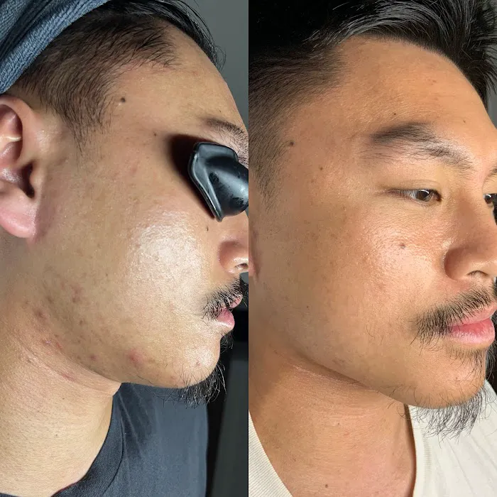 Motiff Aesthetics Picture 8