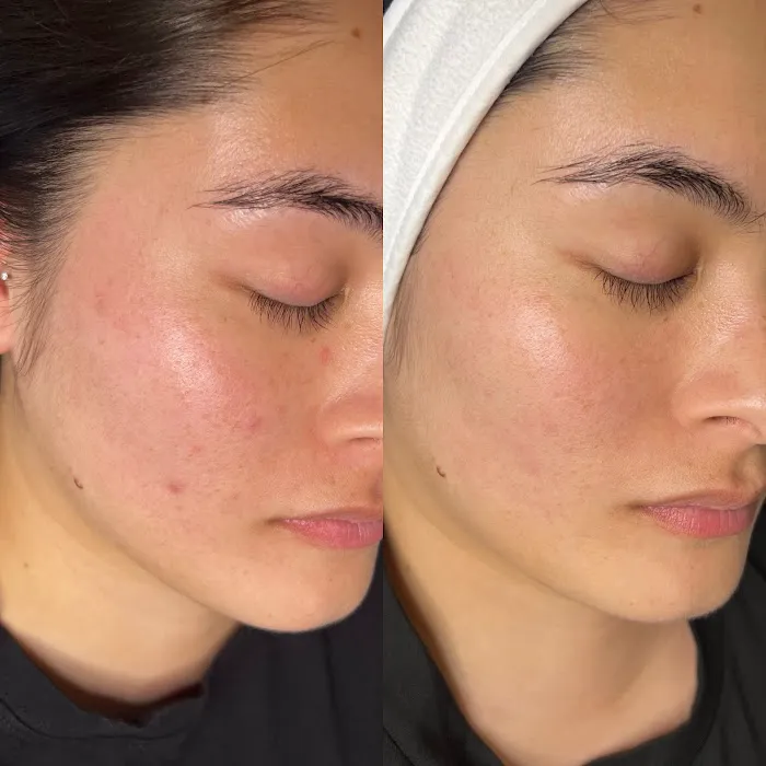 Motiff Aesthetics Picture 10