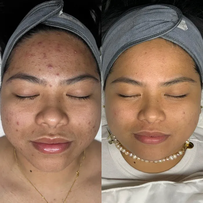 Motiff Aesthetics Picture 6