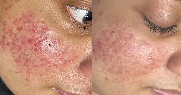 Motiff Aesthetics Picture 5