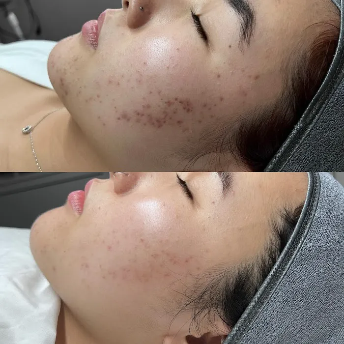 Motiff Aesthetics Picture 9