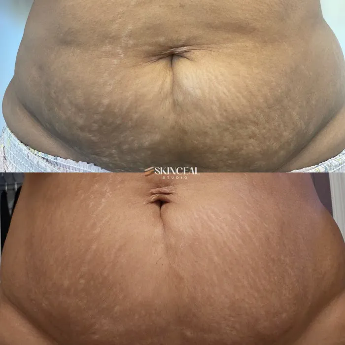 Skinceal Studio Picture 6