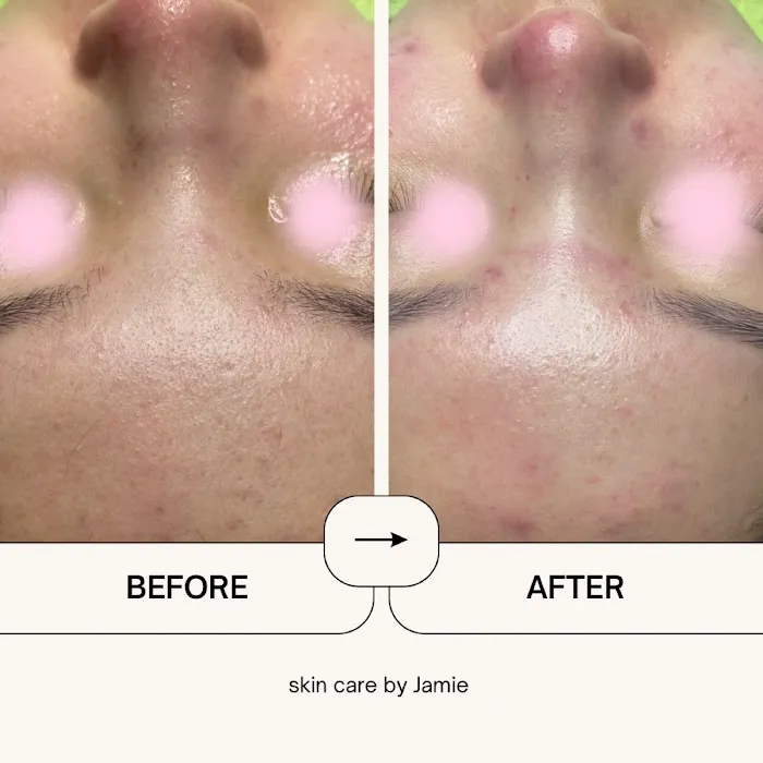 SkinCare by Jamie Picture 9