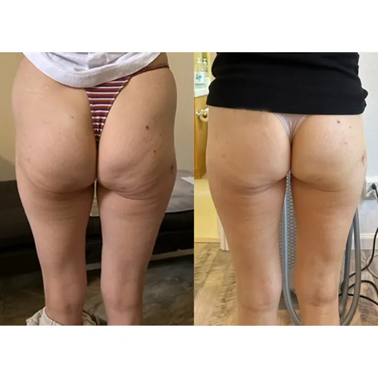 Nozawa Intl, LLC Picture 10