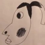 Hyperpigmentation San Jose