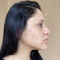 Glow DermSolutions ico