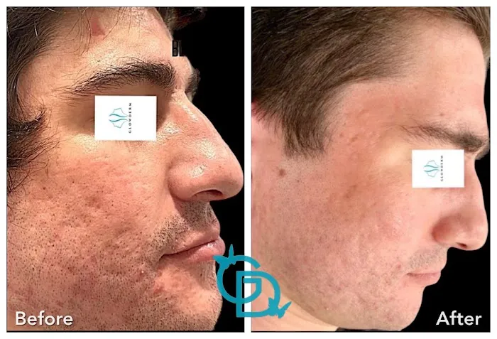 Glow DermSolutions Picture 3