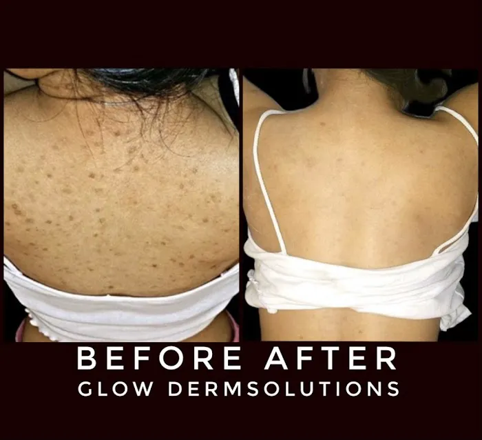 Glow DermSolutions Picture 10