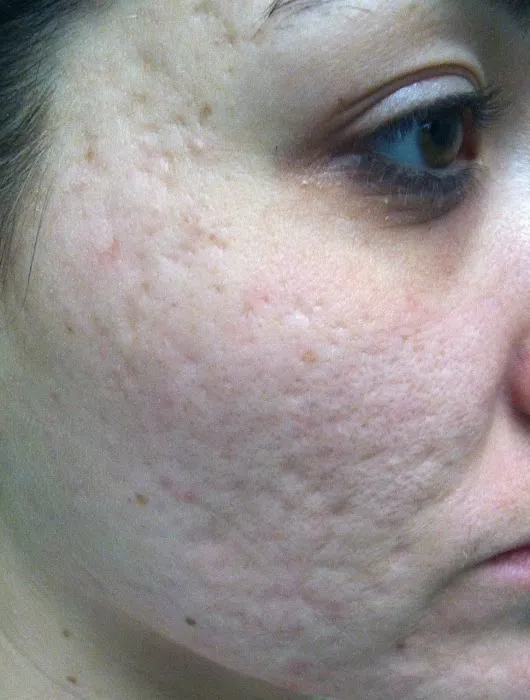 LnL Skin Care Picture 1
