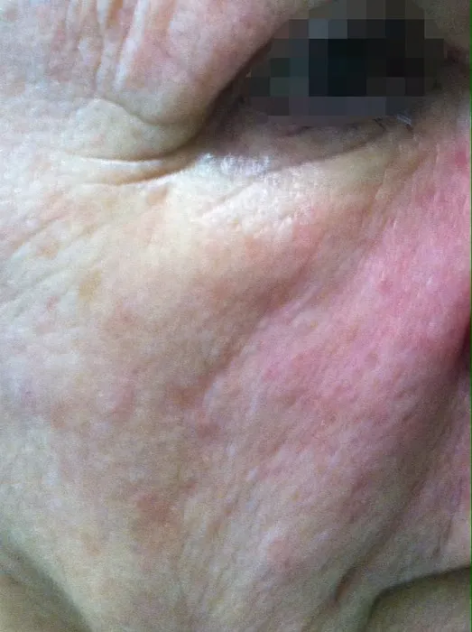 LnL Skin Care Picture 3