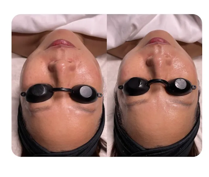 Glow Skin Therapy K-Beauty Facials Picture 6