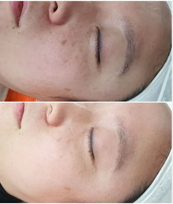 Glow Skin Therapy K-Beauty Facials Picture 8