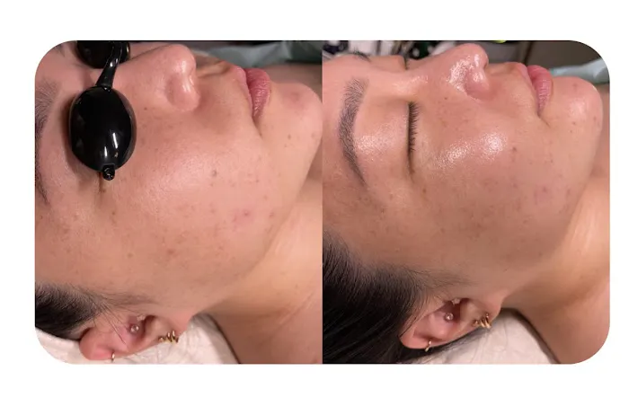 Glow Skin Therapy K-Beauty Facials Picture 4