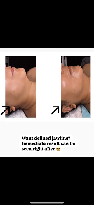 Glow Skin Therapy K-Beauty Facials Picture 9