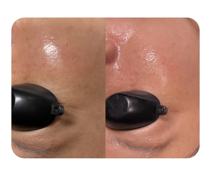 Glow Skin Therapy K-Beauty Facials Picture 10