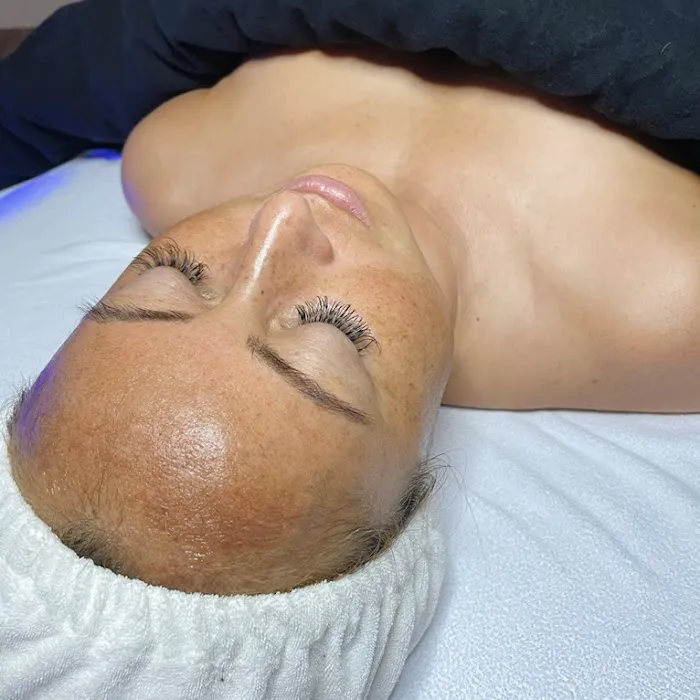 Sugar + Skin Picture 3