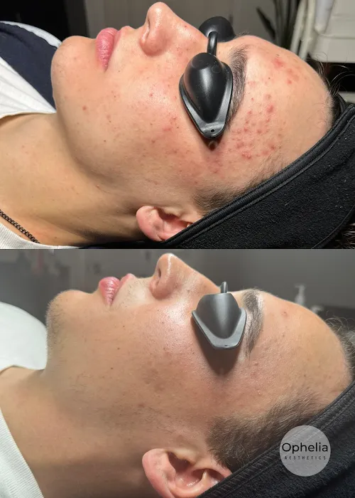 Ophelia Aesthetics Picture 7