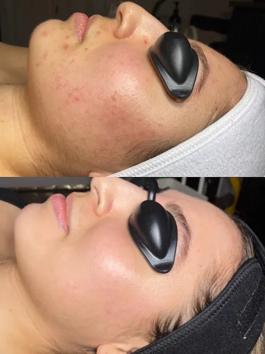 Ophelia Aesthetics Picture 3