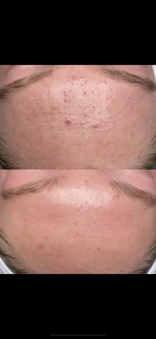 Ophelia Aesthetics Picture 6