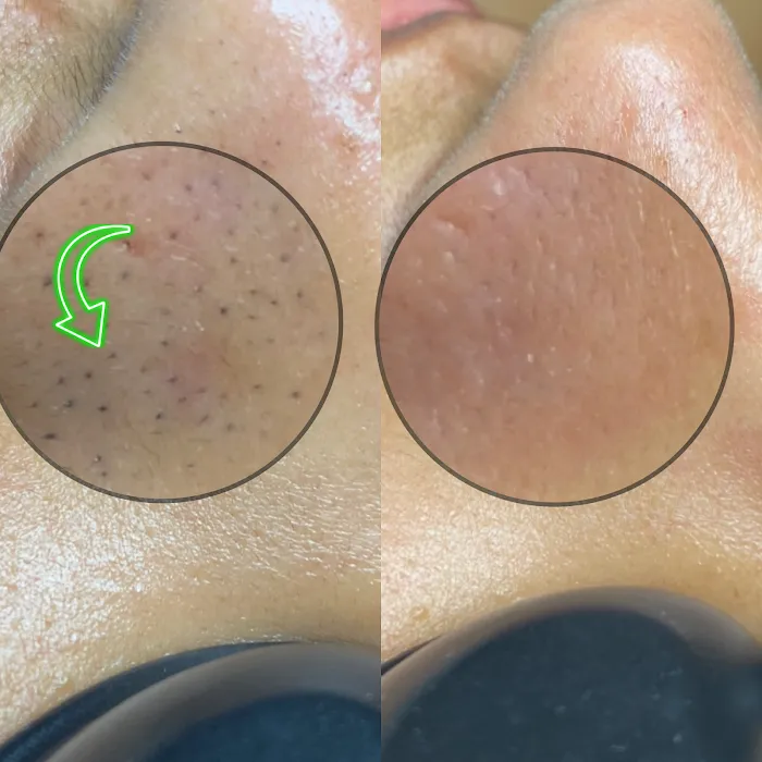 Ophelia Aesthetics Picture 9