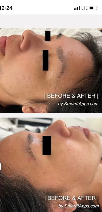 Morgan Hill Skin Care Picture 1