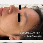 Morgan Hill Skin Care