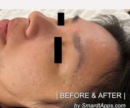 Morgan Hill Skin Care