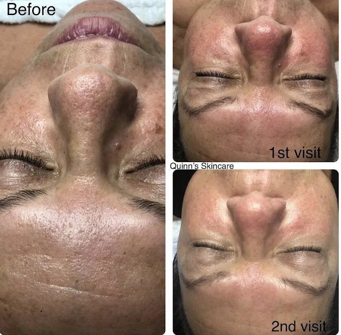Quinn's Skincare Clinic Picture 7