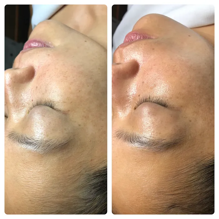 Quinn's Skincare Clinic Picture 9