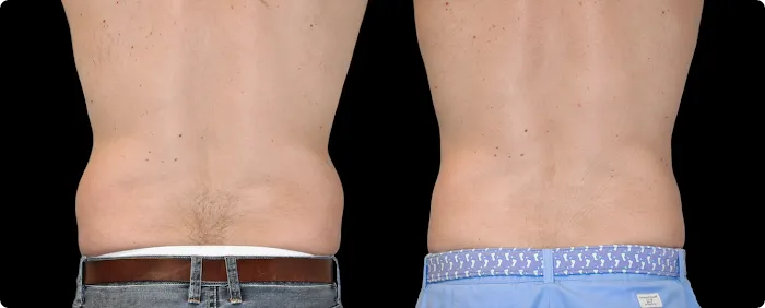 Rejuvé - Botox, CoolSculpting, Laser, Weightloss, Wellness Center Picture 10