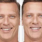 Richard Haxton's Transformational Skin Solutions of Los Altos