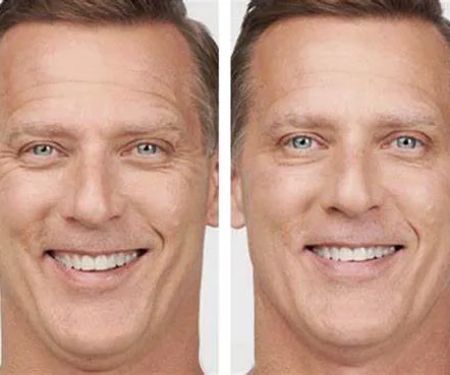 Richard Haxton's Transformational Skin Solutions of Los Altos