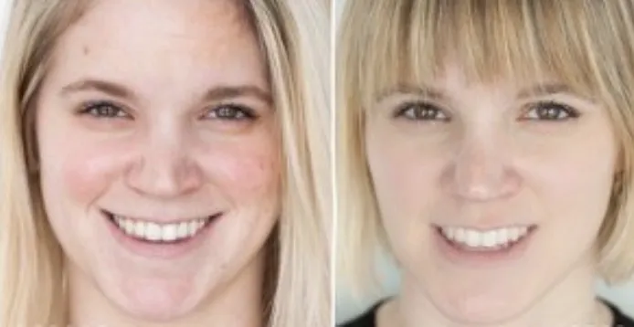 Richard Haxton's Transformational Skin Solutions of Los Altos Picture 6