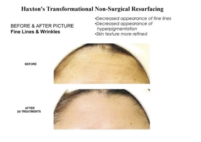 Richard Haxton's Transformational Skin Solutions of Los Altos Picture 8