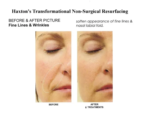 Richard Haxton's Transformational Skin Solutions of Los Altos Picture 5