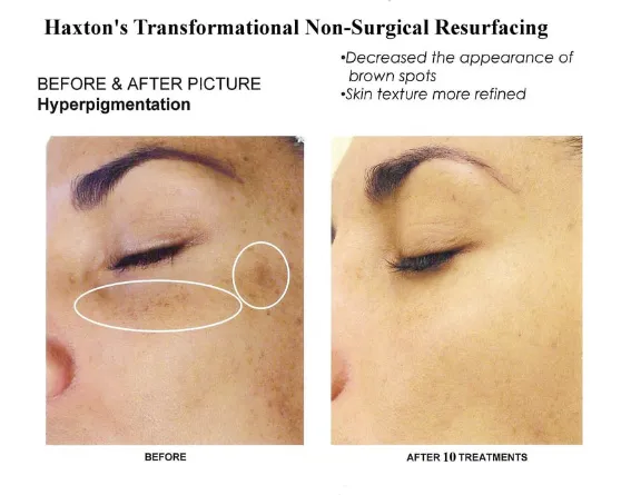 Richard Haxton's Transformational Skin Solutions of Los Altos Picture 7