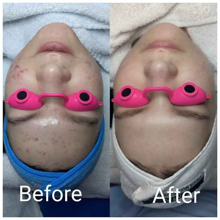 Irina Kucher - Los Altos, CA Picture 10