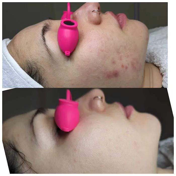 Irina Kucher - Los Altos, CA Picture 7