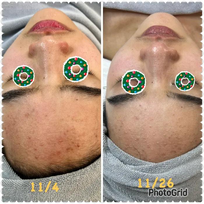 Beauty Koncept Picture 8