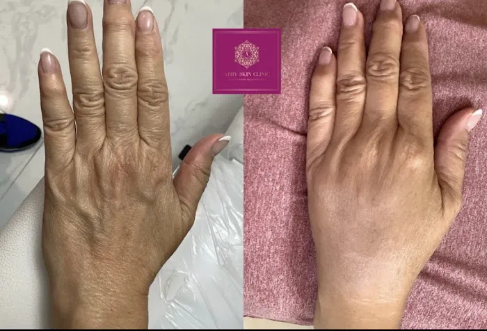 Abby Skin Clinic & FFMS Inc. Medspa Picture 6