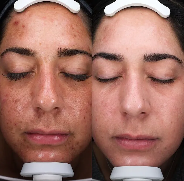 Ashley Aesthetics Picture 8