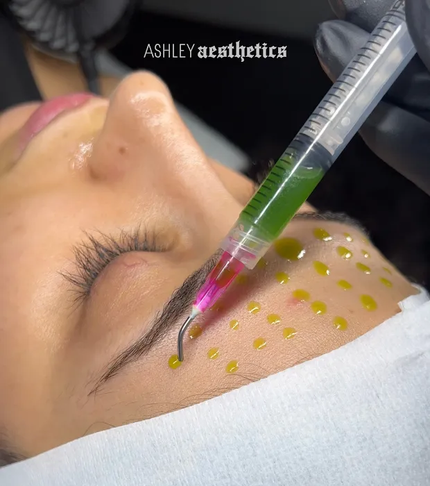 Ashley Aesthetics Picture 9