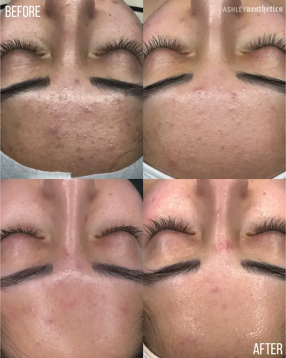 Ashley Aesthetics Picture 10