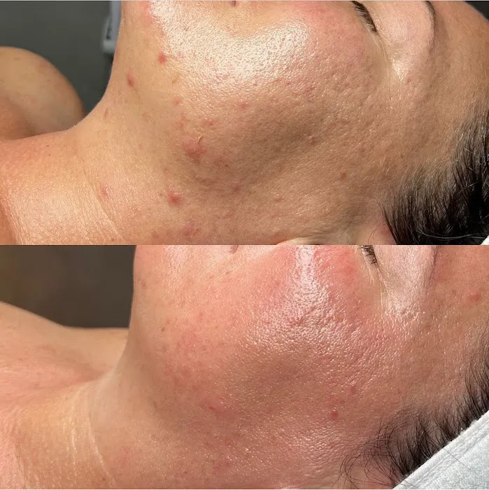 Skin Sessions LG Picture 5